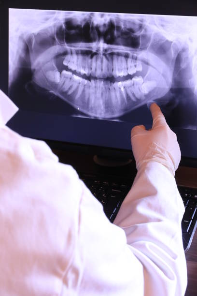 Best Emergency Denture Repair in Milltown, NJ