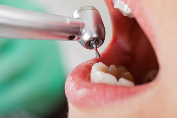 Best Emergency Cosmetic Dentistry (e.g., broken veneers) in Milltown, NJ